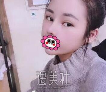 亚韩,郑京湘,做鼻子