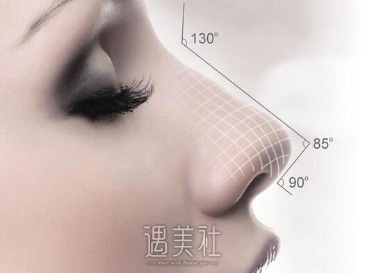 上海,朝天鼻矫正