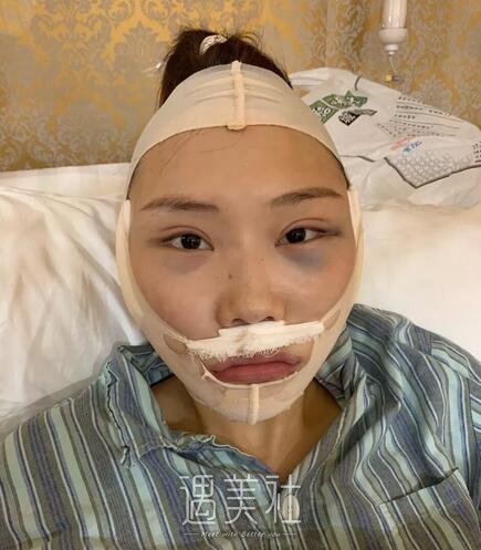 上海,首尔丽格,磨骨