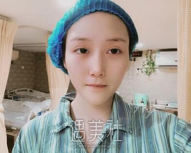上海,首尔丽格,磨骨