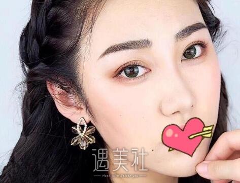 冯斌,吸脂
