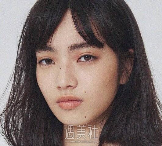 北京,自体脂肪填充
