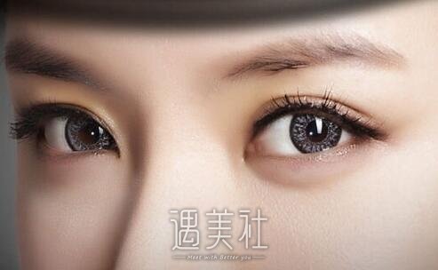 北京,开眼角,双眼皮