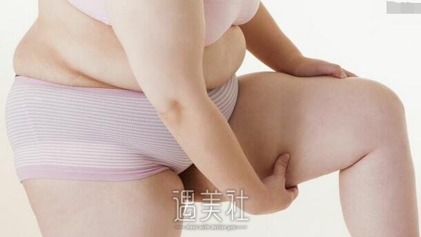 上海,大腿吸脂
