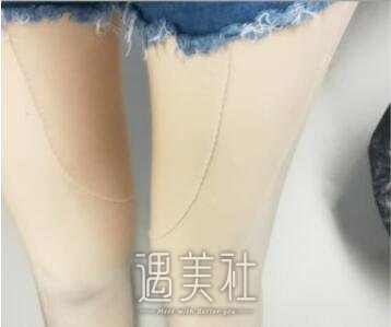大腿环吸
