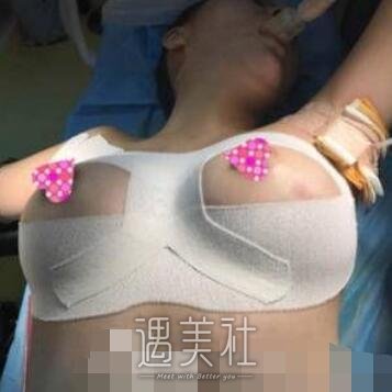 上海,伊莱美,江华,隆胸