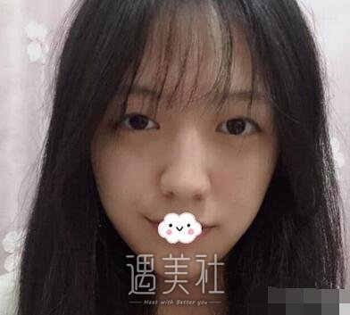邱文苑,双眼皮