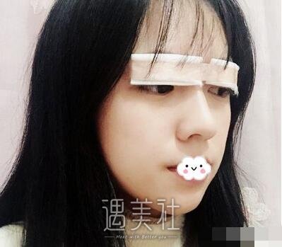邱文苑,双眼皮