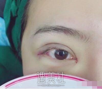 邱文苑,双眼皮