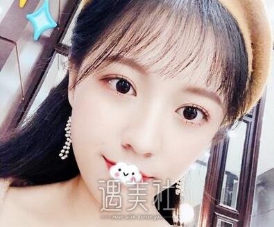 邱文苑,双眼皮