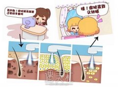 揭阳做彩光嫩肤多少钱，为什么价格有高有低? width=