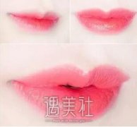南阳玻尿酸注射丰唇价格怎么样，是不是很贵? width=