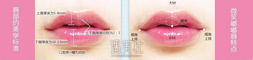 玻尿酸注射丰唇