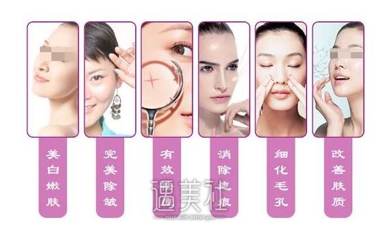 激光嫩肤