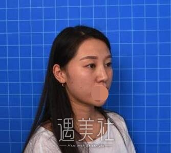 九院