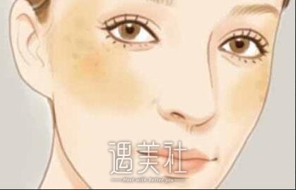 石家庄,彩光祛斑