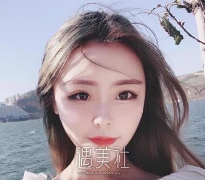 上海,李元山,隆鼻