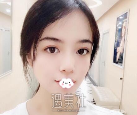 上海,九院,施耀明,双眼皮