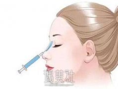 大连玻尿酸注射隆鼻的听说有点小贵，是不是真的？ width=