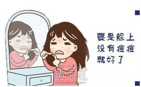 激光祛痘