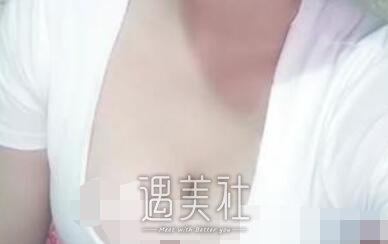 栾杰,隆胸