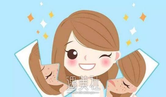 激光祛斑价格