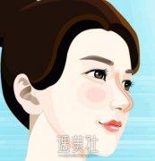 福州隆鼻手术收费贵不贵，怎么判断价格高低? width=