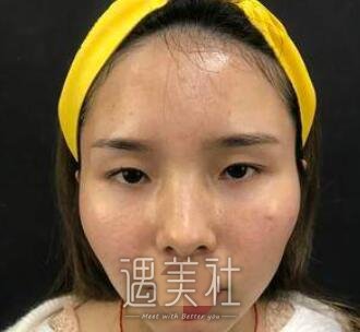 赵延勇