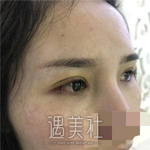 赵延勇