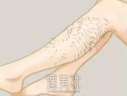 腿部脱毛