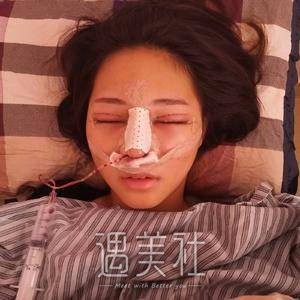 龚涛,隆鼻