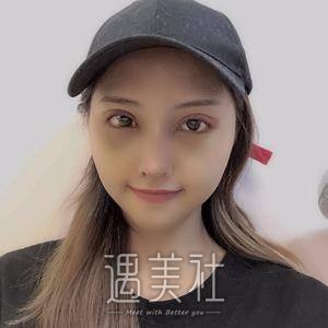 龚涛,隆鼻