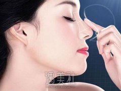 哈尔滨异体软骨鼻子价格贵不贵，几千到几万不等是为什么？ width=