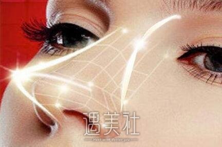 哈尔滨,异体软骨鼻子