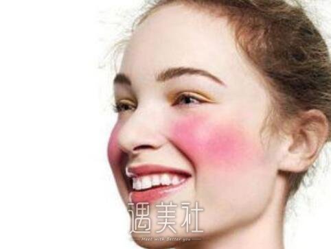 光子调节红血丝