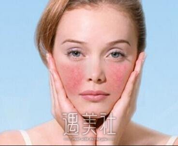 光子调节红血丝