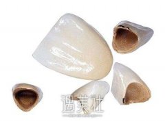 西安钴铬合金烤瓷牙售价是多少?什么影响了市场价? width=
