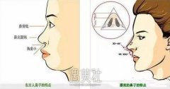 兰州假体隆鼻价格是多少钱，做一个鼻子这么贵? width=