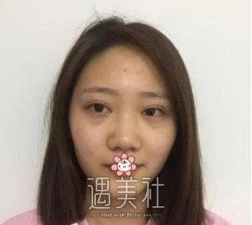 李青峰,做鼻子