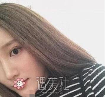 李青峰,做鼻子