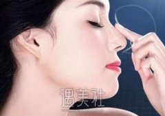 自体脂肪填充隆鼻没问题吗？一起来看看~ width=