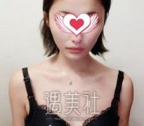 李朕丰胸案例新上线：飞机场秒变性感女神！ width=