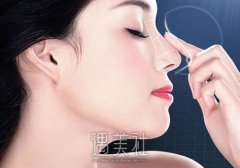 成都整容鼻子大概多少钱，为什么价格忽高忽低？ width=