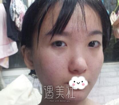 吉大二院整形科