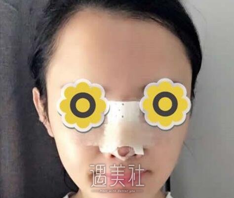 成都,华美,宋晓东,隆鼻