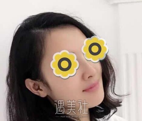 成都,华美,宋晓东,隆鼻