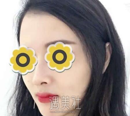 成都,华美,宋晓东,隆鼻