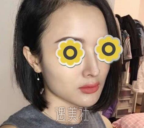 成都,华美,宋晓东,隆鼻