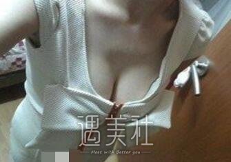 沈正宇,隆胸