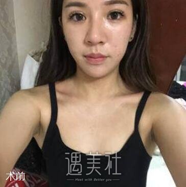 八大处,唐勇,隆胸